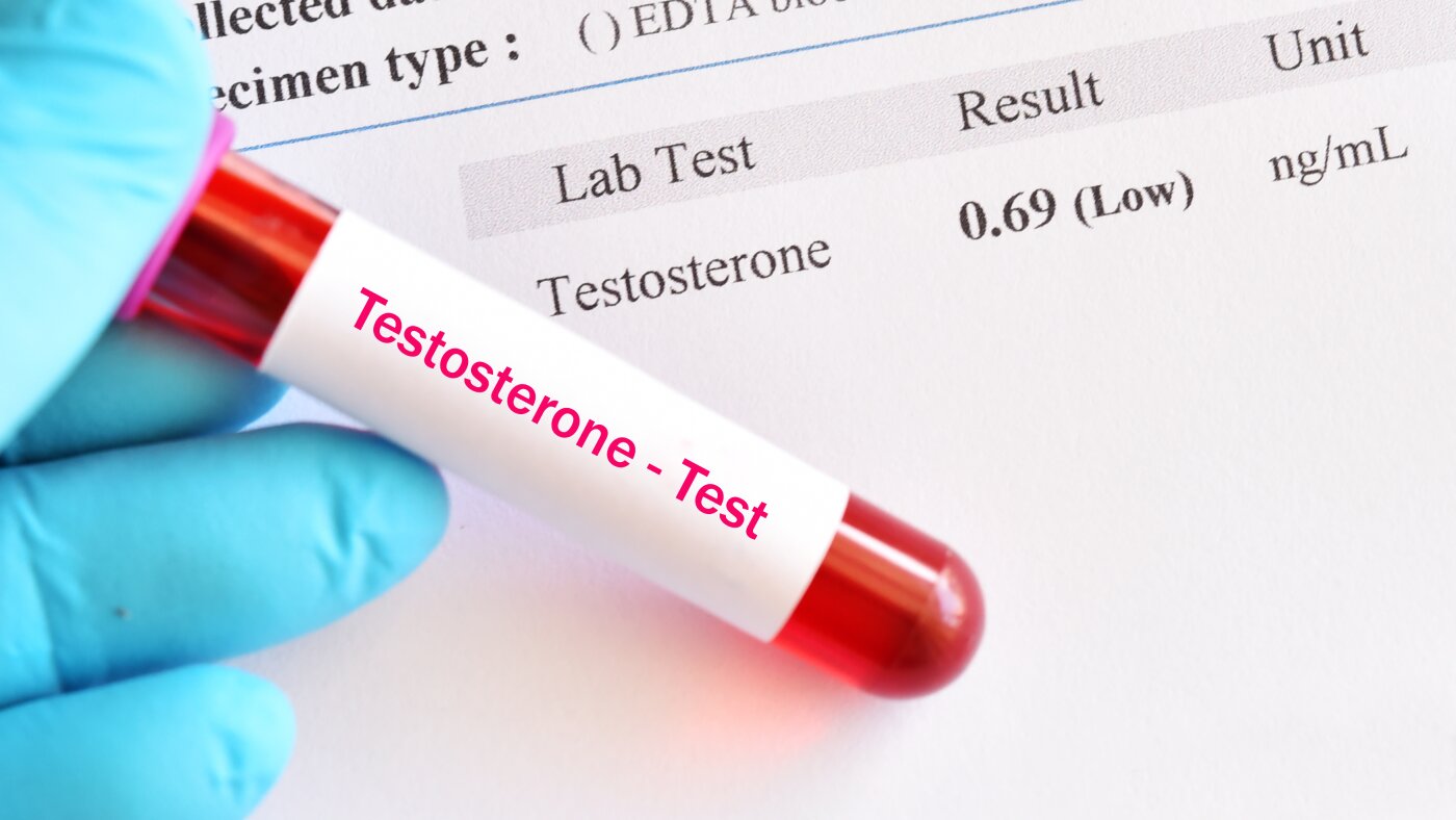 Testosterone is having a moment. But who actually needs it? : NPR Testosterone is having a moment. But who actually needs it? : NPR