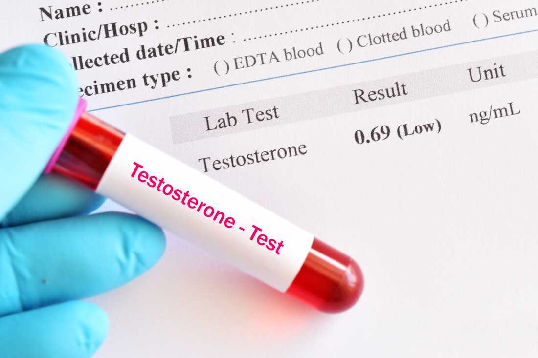 The military plans to start screening service members for low testosterone, and social media is overflowing with claims about testosterone therapy.