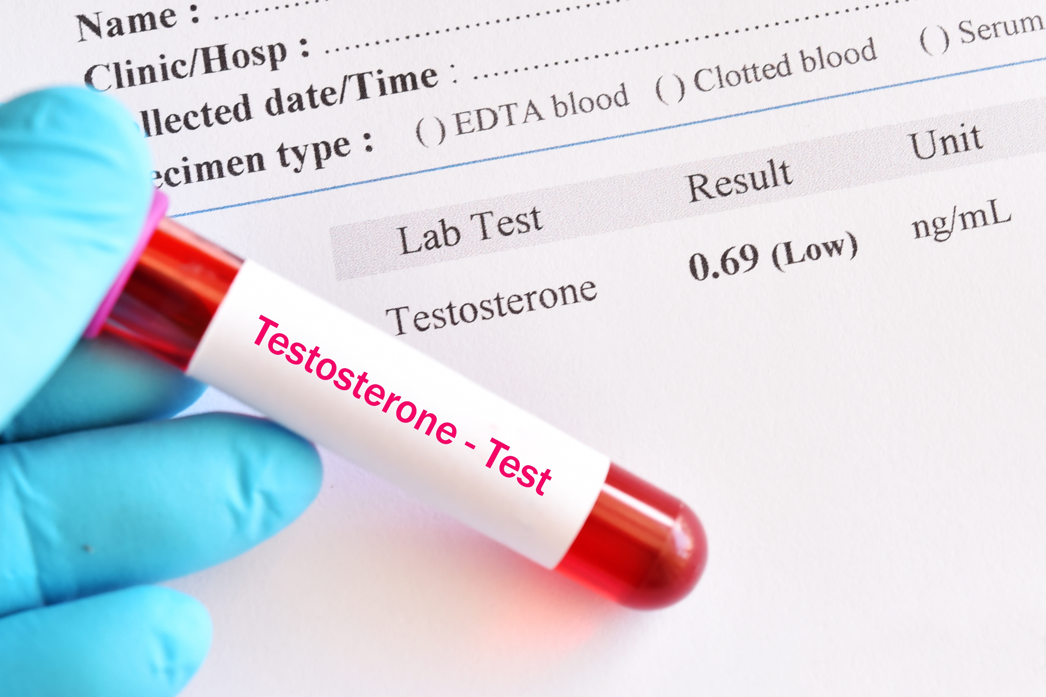 Who really needs testosterone?