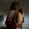 In this photo, Hidaya carries her sick 18-month-old son, Mohammed al-Mutawaq, who is displaying signs of malnutrition, inside their tent in Gaza on July 24, 2025. Mohammed's back ribs and spine are visibly sticking out.