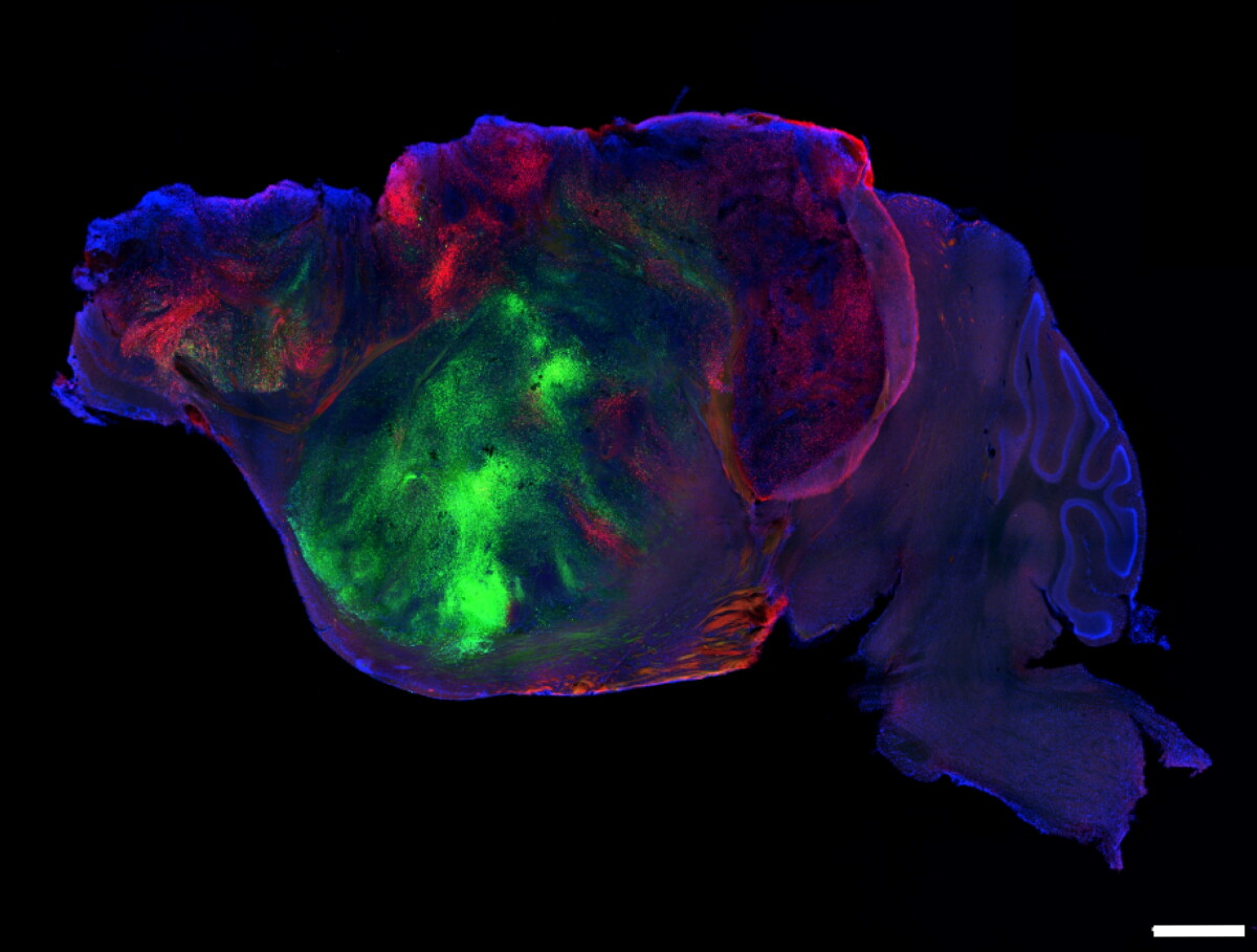 Mice with human brain cells offer a tool to study disease. Ethicists ask: What's next?