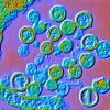 Colour enhanced transmission electron micrograph (TEM) of Hantavirus particles. Hantavirus is a respiratory disease carried in wild rodents such as deer mice. Mice do not appear ill while carrying the hantavirus. People become infected after breathing airborne particles of urine, droppings or saliva from infected rodents. Hantavirus causes flu-like symptoms that eventually cause the lungs to fill with fluid, making breathing difficult. Medical attention must be sought as soon as infection is detected. Most cases of Hantavirus reported in the U.S. have been in the rural Western states.
