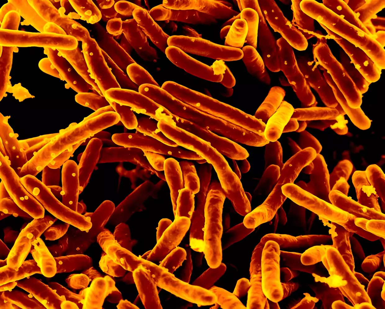 A scanning electron micrograph of Mycobacterium tuberculosis bacteria, which cause TB.