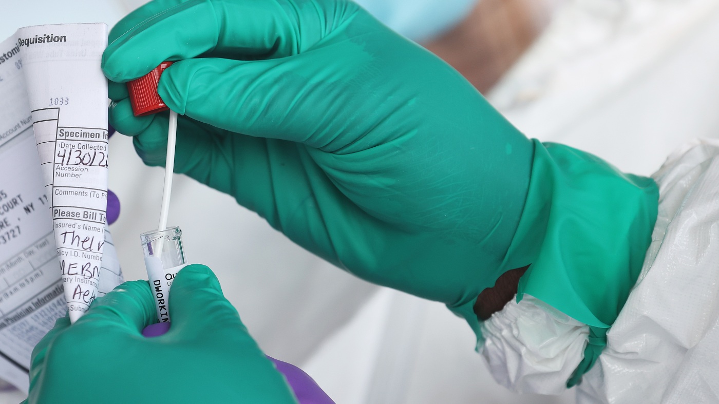 Liczba zachorowań na Covid-19 rośnie tego lata. Oto dlaczego i co jeszcze powinieneś wiedzieć: NPR Liczba zachorowań na Covid-19 rośnie tego lata. Oto dlaczego i co jeszcze powinieneś wiedzieć: NPR