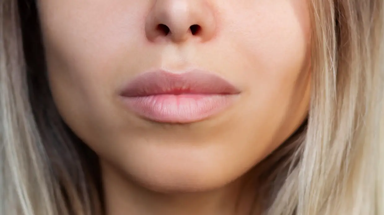 In pursuit of 'Instagram face,' are we losing the imperfections that make us human?