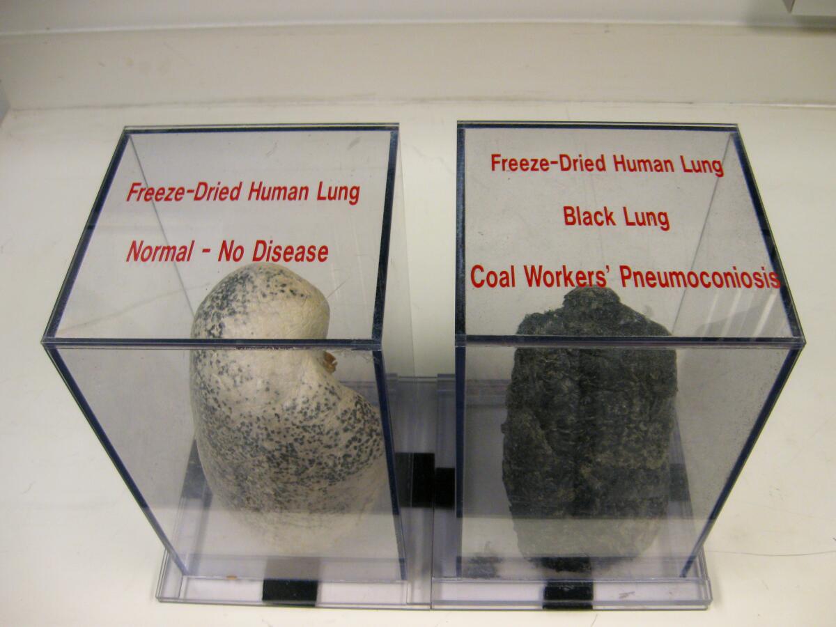 A display at the National Institute for Occupational Safety and Health in Morgantown, West Virginia, compares a preserved healthy lung with the coal-black lung of a coal miner who died from black lung disease.