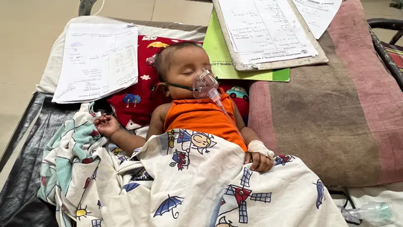 Six-month-old Sumaiya Saima is getting oxygen support due to measles complications at the Shishu Hospital of Dhaka.