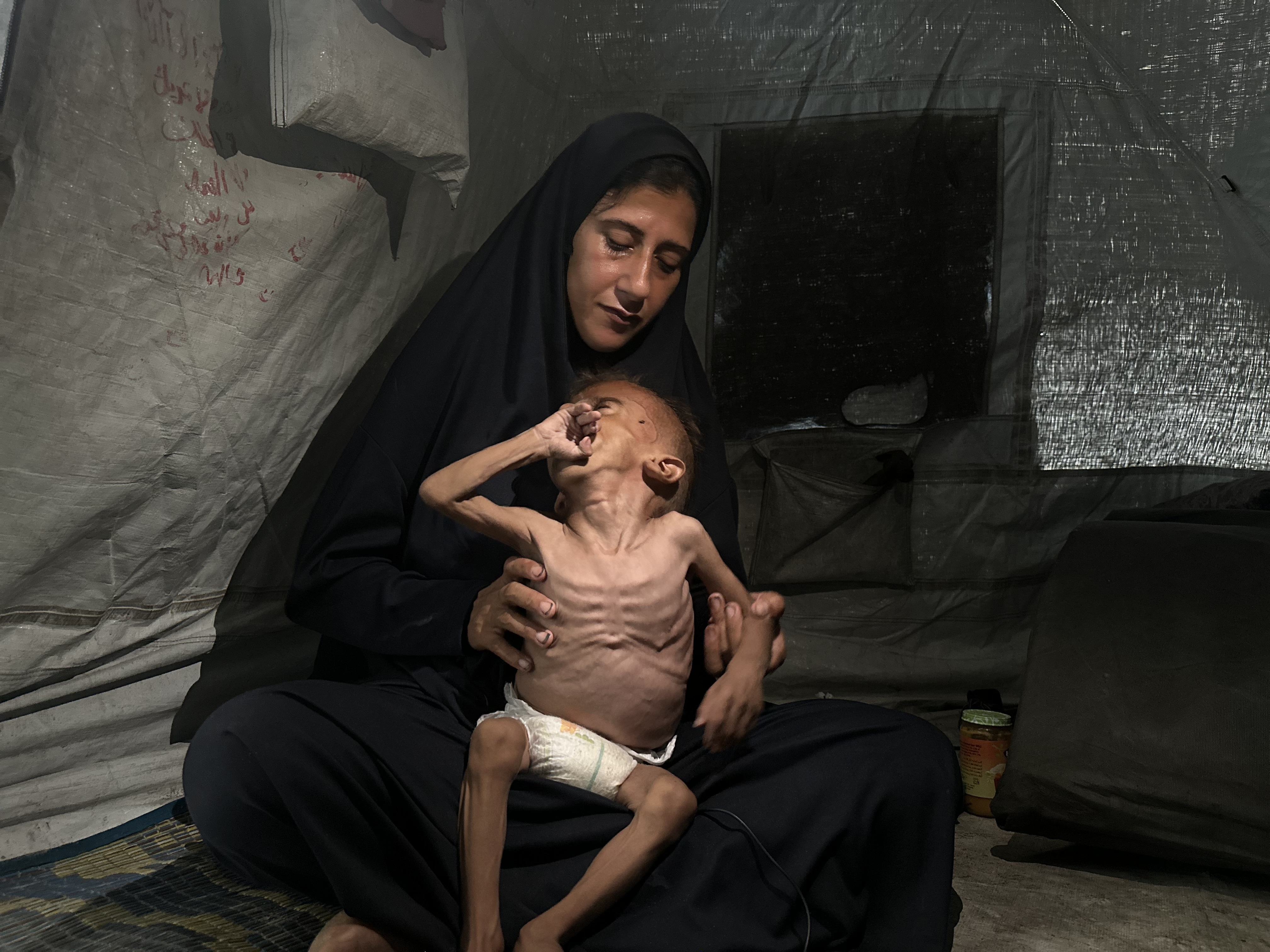 The Story Behind a Famous Photo of a Starving Child in Gaza