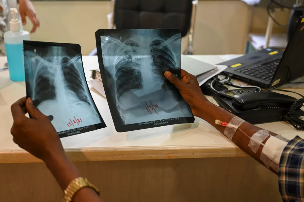 A patient who was diagnosed with tuberculosis holds his chest x-rays while consulting with a doctor at the Médecins Sans Frontières clinic in Mumbai, which treats people with drug-resistant tuberculosis.