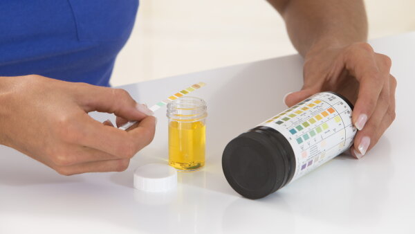 A person using a urine analysis test holds a test strip and compares it to a chart on the bottle.