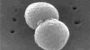 This electron microscopic image provided by the Centers for Disease Control and prevention depicts two, round-shaped, Gram-positive, Streptococcus pneumoniae bacteria.