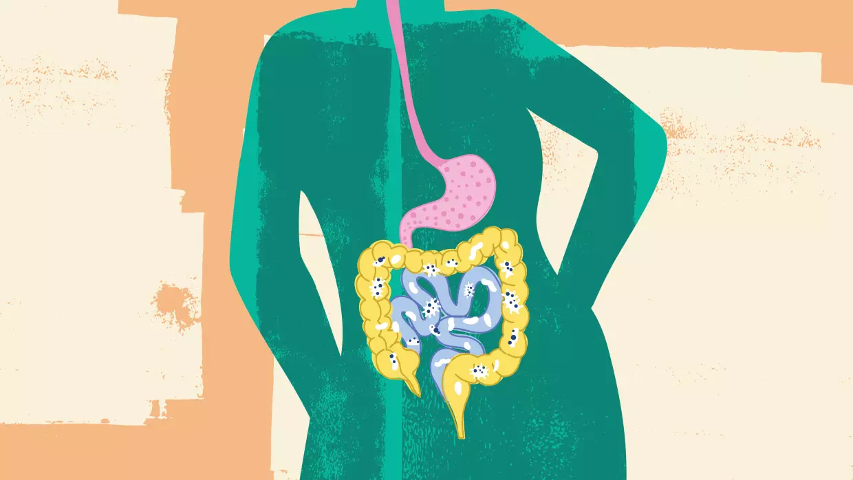 In healthy people, the specific makeup of the gut microbiome can vary considerably based on geography, lifestyle, diet, genetics and other factors.
