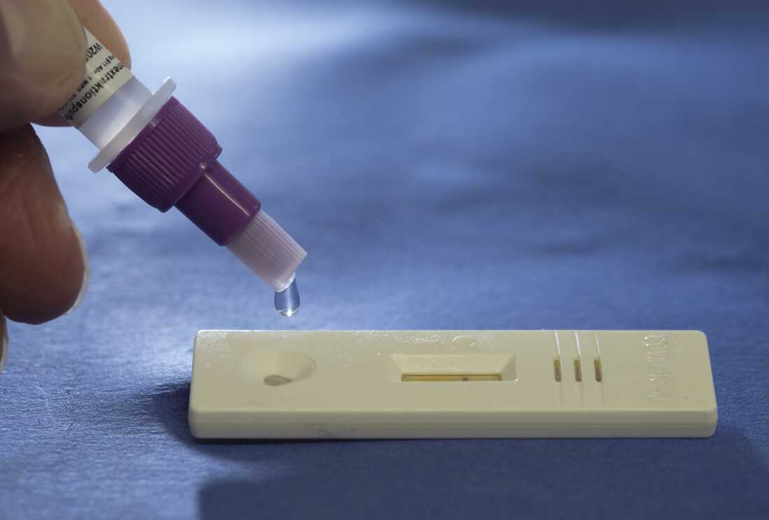 A small, beige piece of plastic is pictured with a dropper adding a drop of fluid to this testing strip.