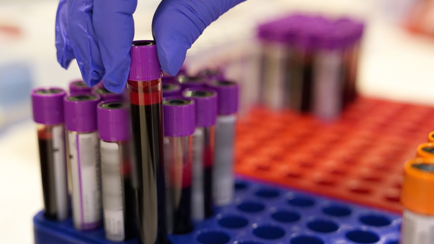 New blood tests can help diagnose Alzheimer’s. Doctors are still catching up : Shots New blood tests can help diagnose Alzheimer’s. Doctors are still catching up : Shots
