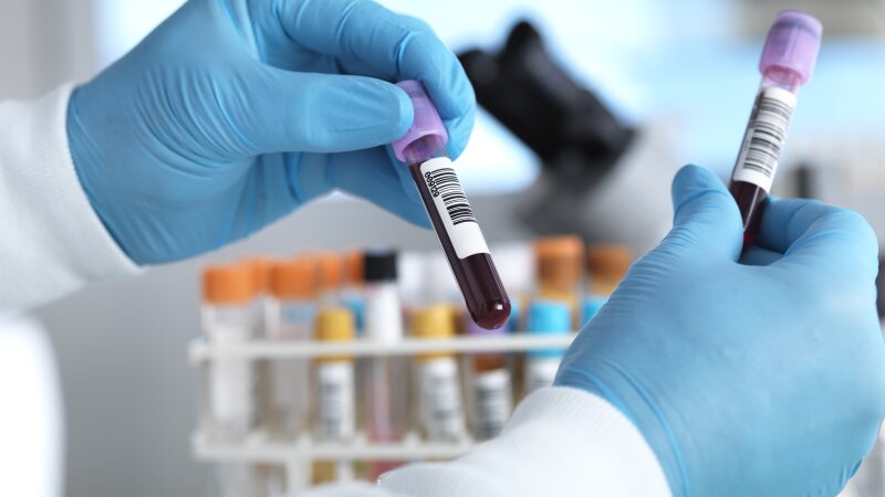 Gloved hands hold blood samples in a lab.