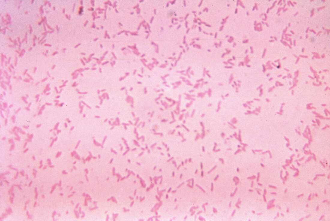 This micrograph depicts Bacteroides fragilis ss fragilis bacteria cultured in blood agar medium for 48 hours, 1972. Gram-negative B. fragilis, though a commensal bacteria that normally lives in the human gastrointestinal tract, can become pathogenic under circumstances involving disruption of the normal intestinal mucosa such as trauma, or surgery.