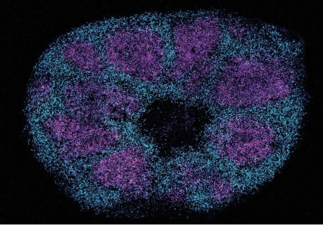 This image shows a section of an organoid, lab-grown tissues that model the human brain. A new study used brain organoids to probe key protein interactions that may be linked to profound autism.