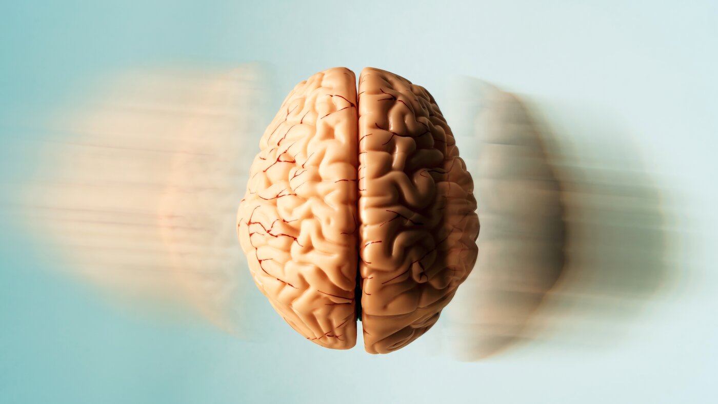 Our favorite brains, including Einstein's stolen one