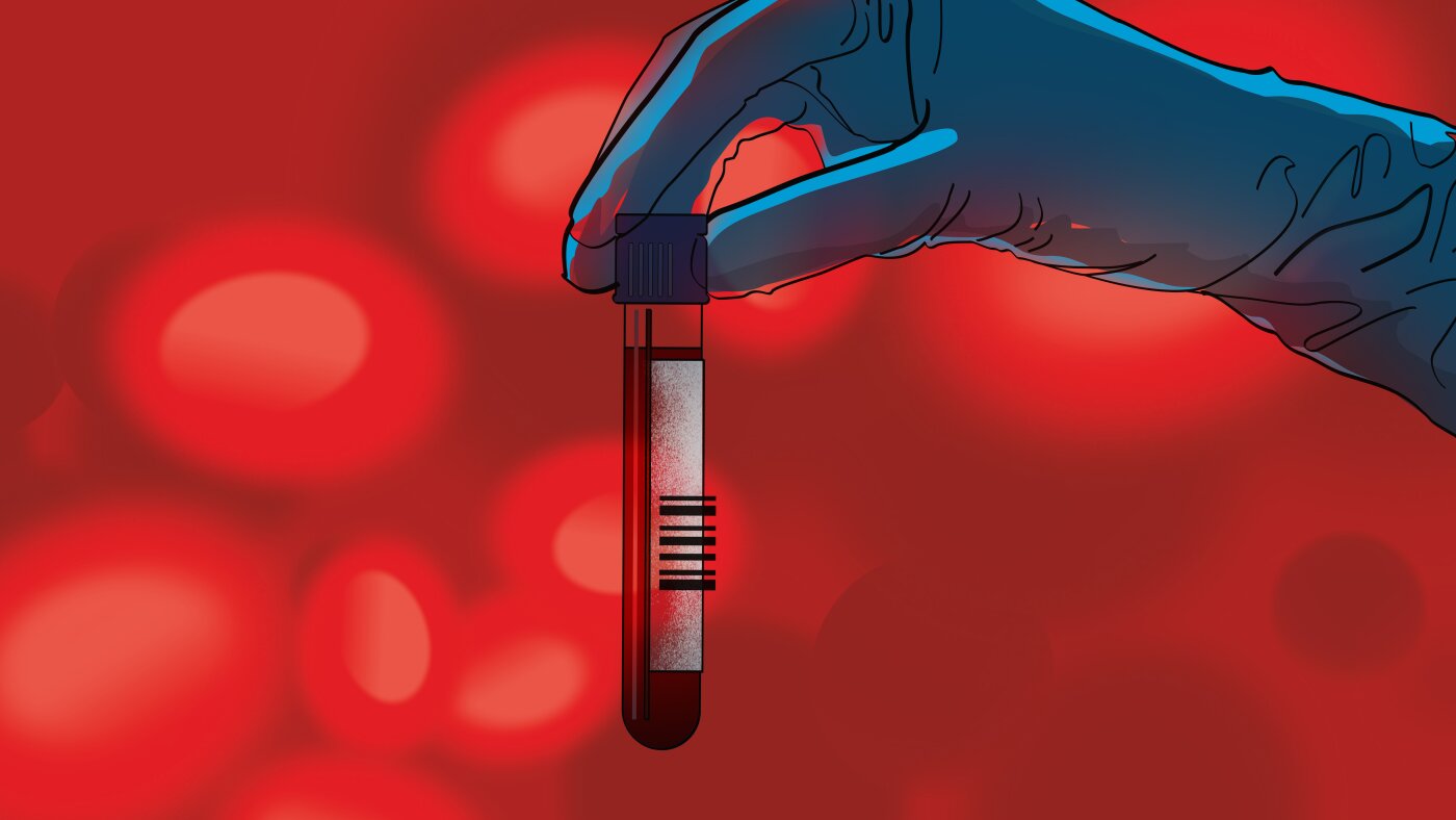 A blood test that screens for multiple types of cancer? It may be available soon