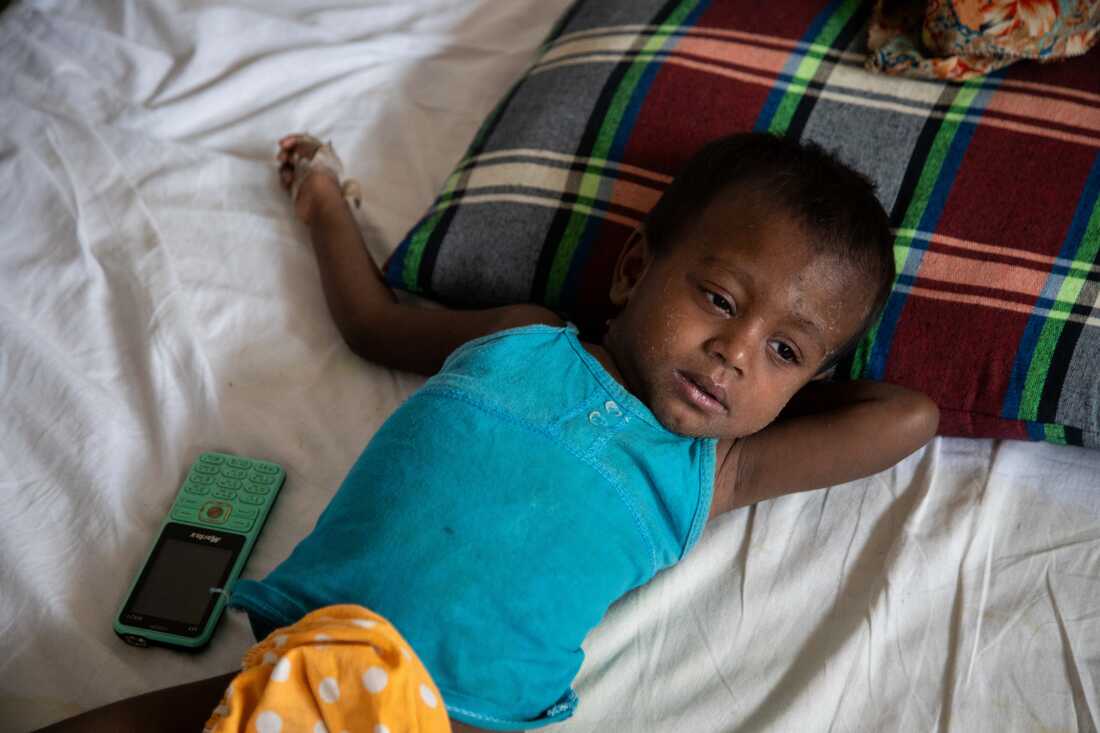Saifa, a child infected with measles, lies on a bed after being admitted to DNCC Hospital in Dhaka, Bangladesh, May 17, 2026.