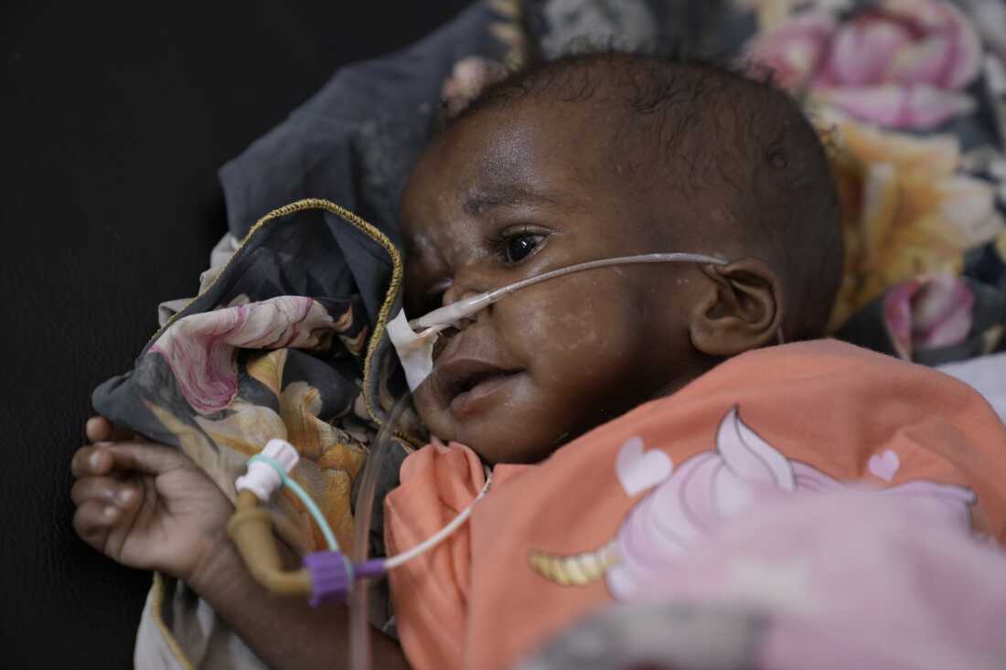 A babe being treated astatine nan malnutrition ward successful Al Buluk.