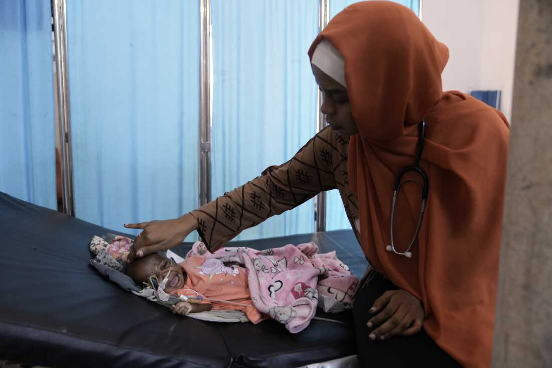 Dr Sara Abdurahaman astatine Al Buluk infirmary treating an 8-month aged babe successful nan captious attraction portion of a malnutrition ward.