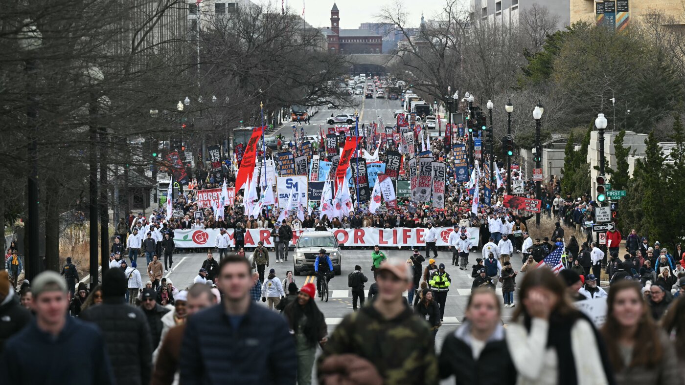 Variety of abortions within the U.S. holds regular at 1.1 million, a brand new report says : NPR Variety of abortions within the U.S. holds regular at 1.1 million, a brand new report says : NPR