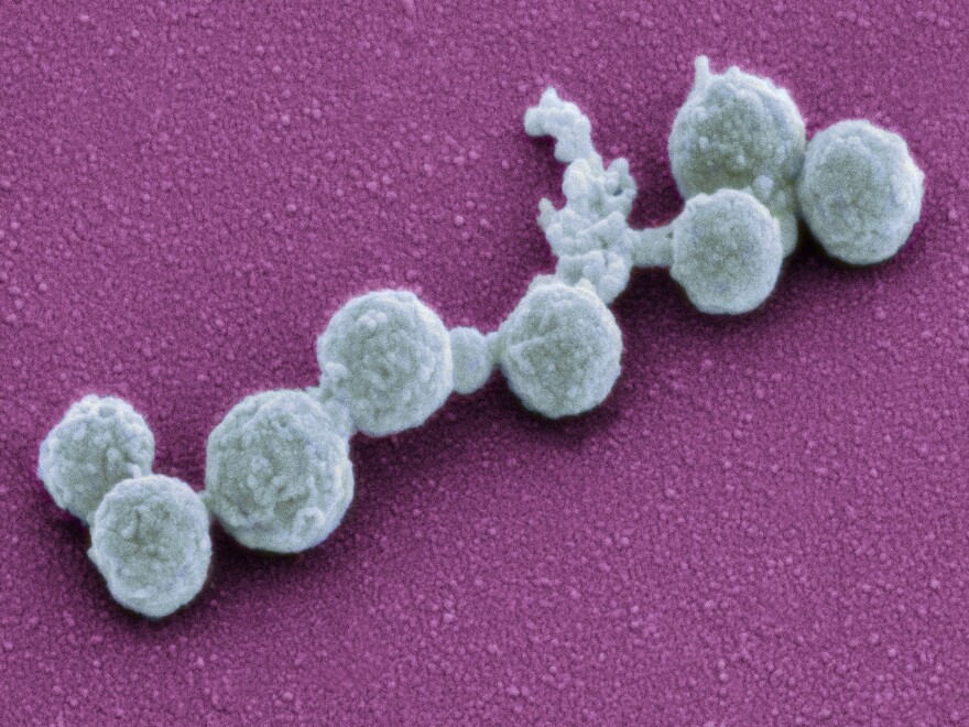 In 2010, scientists plopped the genetic material of one <em>Mycoplasma</em> bacterium into another type to create the self-replicating cells shown above. Six years later, they've come out with an even simpler synthetic organism that has fewer genes.