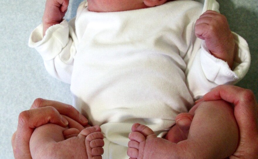 Alice Snyder was born with clubfoot, a common birth defect.