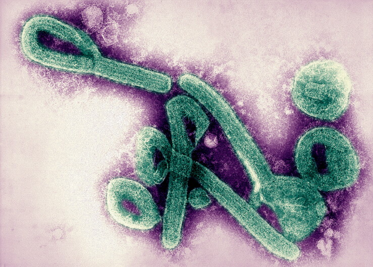 An image the Marburg virus made with an electron microscope and then colorized.