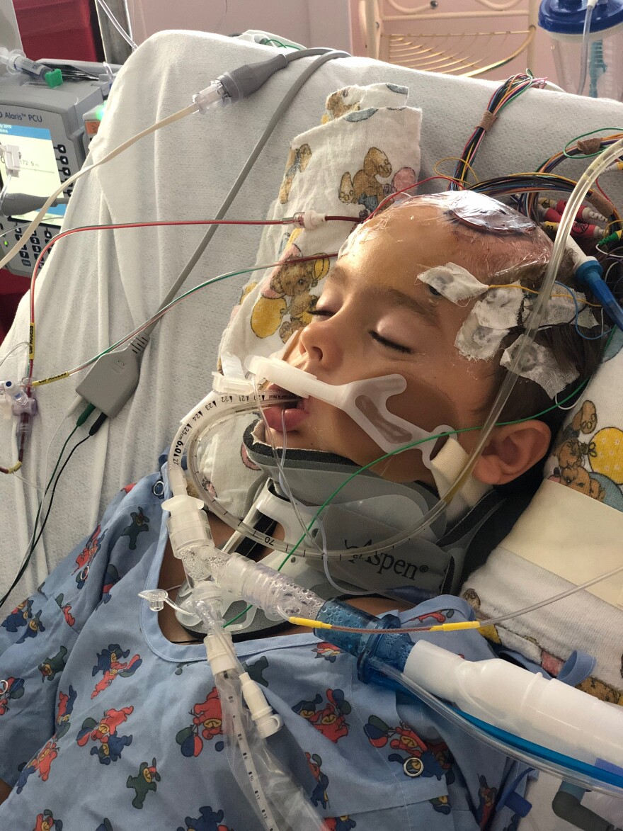 Blake Collie in the hospital after a blood vessel burst in his brain. His care was covered by Medicaid, but his family has a health-sharing plan under Samaritan Ministries, a faith-based organization. 