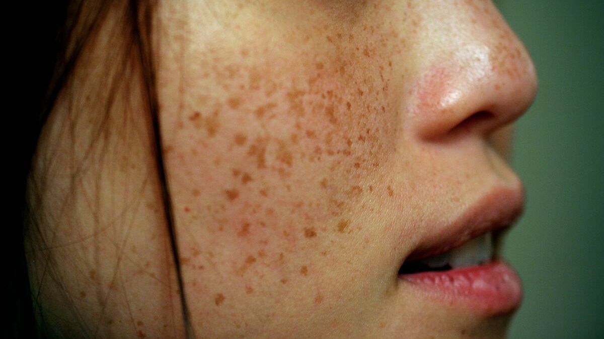 pt141 peptide nasal spray where to buy PT-141 Peptide Therapy