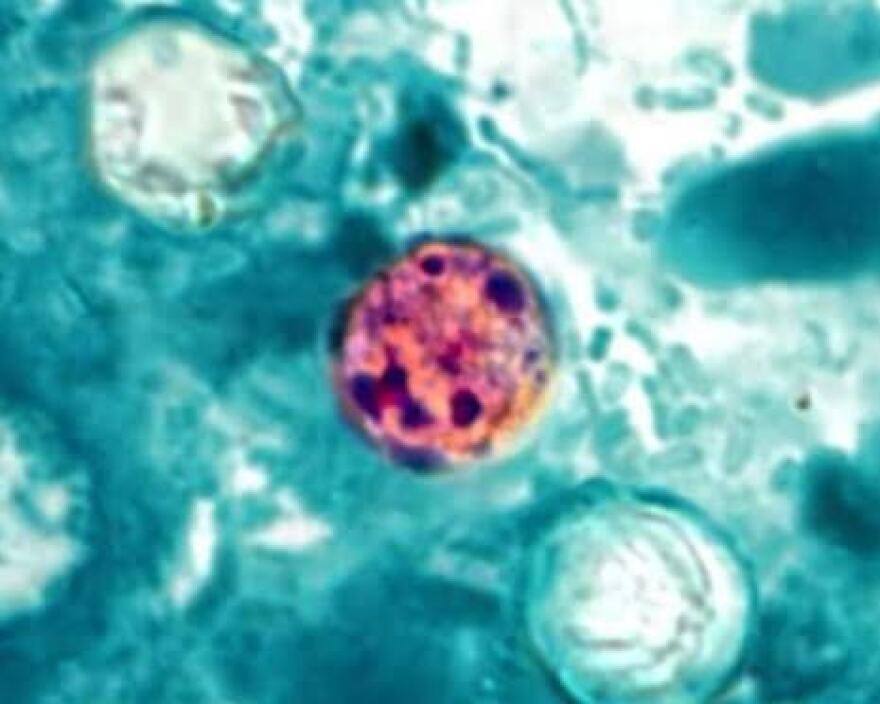 cyclosporiasis