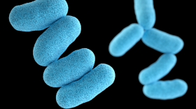 A computer-generated image of Corynebacterium diphtheriae, which can cause respiratory or skin infections in diphtheria patients.