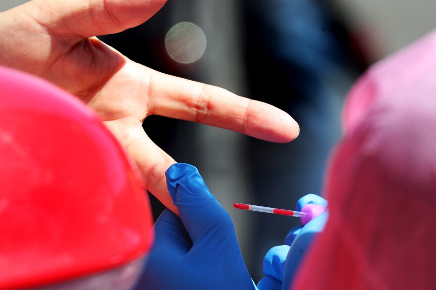 Stanford medical student Thomas Koehnkz takes a blood sample from Alan Wessel of Mountain View, Calif., for a coronavirus antibody study. [Ray Chavez / MediaNews Group/The Mercury News via Getty Images]