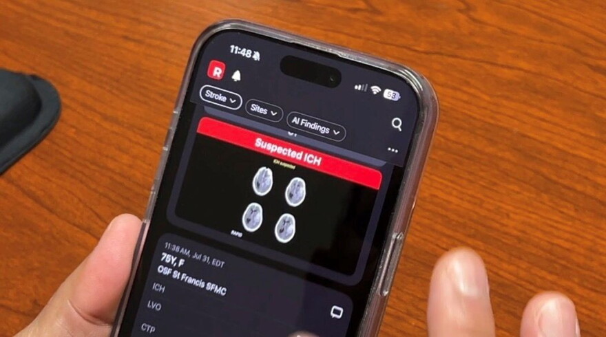 a hand holding a smart phone with brain images from Rapid AI on the screen.