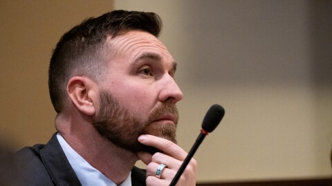 A bearded man holds his chin between his left forefinger and thumb