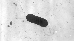 This 2002 electron microscope image made available by the Centers for Disease Control and Prevention shows a Listeria monocytogenes bacterium. One death and nearly two dozen hospitalizations are being tied to a new listeria outbreak of unknown origins, health officials said Thursday, June 30, 2022. The CDC has not identified a food that might be spreading the deadly bacteria, but officials are alerting the public to be alert to symptoms and the possibility of infection. 