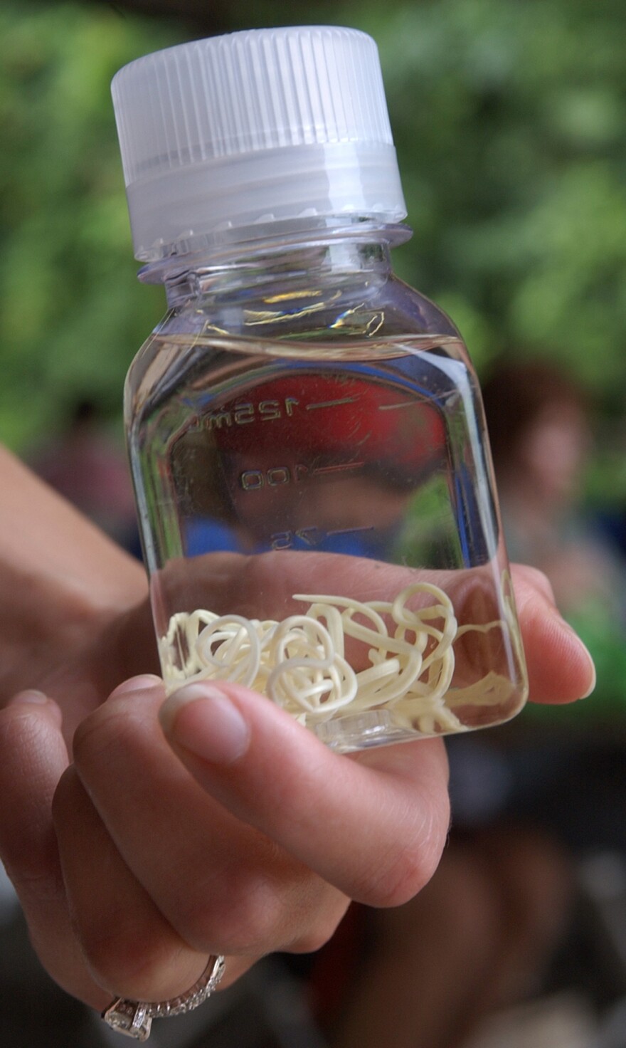 The Guinea worm can grow up to 3 feet inside a person's body.