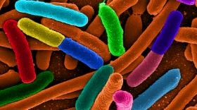 E. coli bacteria. At least 2,000 Americans are hospitalized and about 60 die as a result of E. coli infection each year.