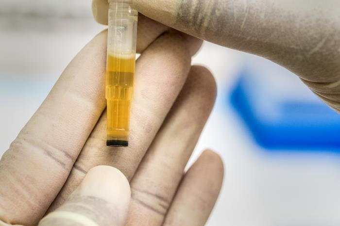 This is a close view of a specimen, prepared for the CDC serologic test to identify the presence of SARS-CoV-2 antibodies, which is a sign of past infection with the virus that causes COVID-19.