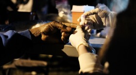 A migrant worker in a Connecticut apple orchard gets a medical checkup in 2017. A proposed rule by the Trump administration that would prohibit some immigrants who get Medicaid from working legally has already led to a lot of fear and reluctance to sign up for medical care, doctors say.