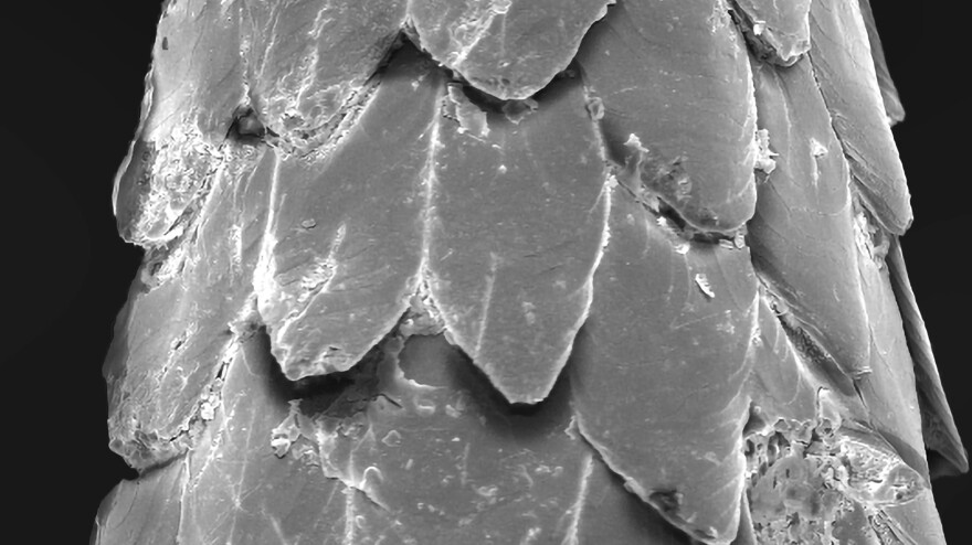 This image from a scanning electron microscope homes in on the tiny barbs on the tip of a porcupine quill.