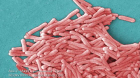 Under a moderately high magnification, this colorized scanning electron microscopic image depicts a large grouping of Gram-negative Legionella pneumophila bacteria. These bacteria cause Legionnaires' disease and Pontiac Fever, collectively known as Legionellosis.