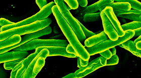 A colorized image of Mycobacterium tuberculosis bacteria, which cause TB.