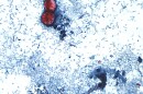 This undated photo taken through a microscope provided by the CDC shows Cyclospora cayetanensis oocysts found in a fresh stool sample which had been prepared with a formalin solution and stained with safranin.