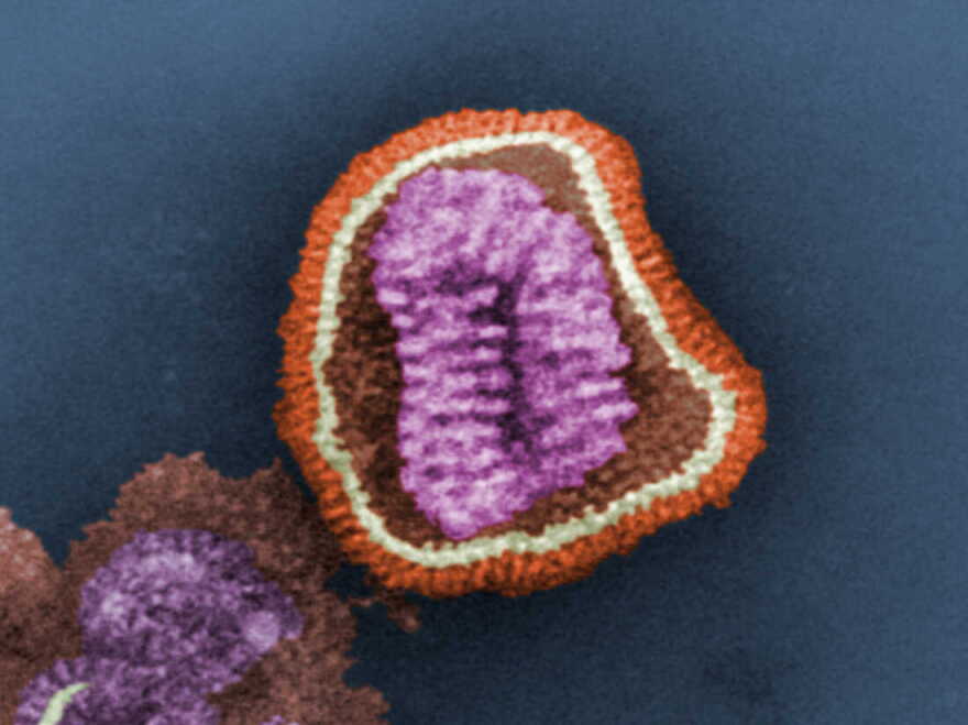 1981 Dr. Erskine. L. Palmer; Dr. M. L. Martin This negative-stained transmission electron micrograph (TEM) depicts the ultrastructural details of an influenza virus particle, or “virion”. T he influenza virus is a single-stranded RNA organism.