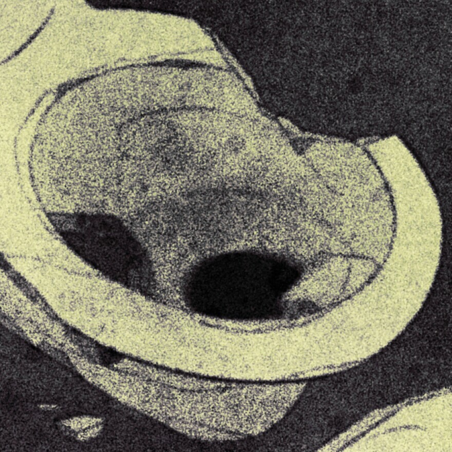 An illustration with muted green tones shows a cracked, dirty toilet bowl.