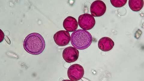 Birch pollen grains.