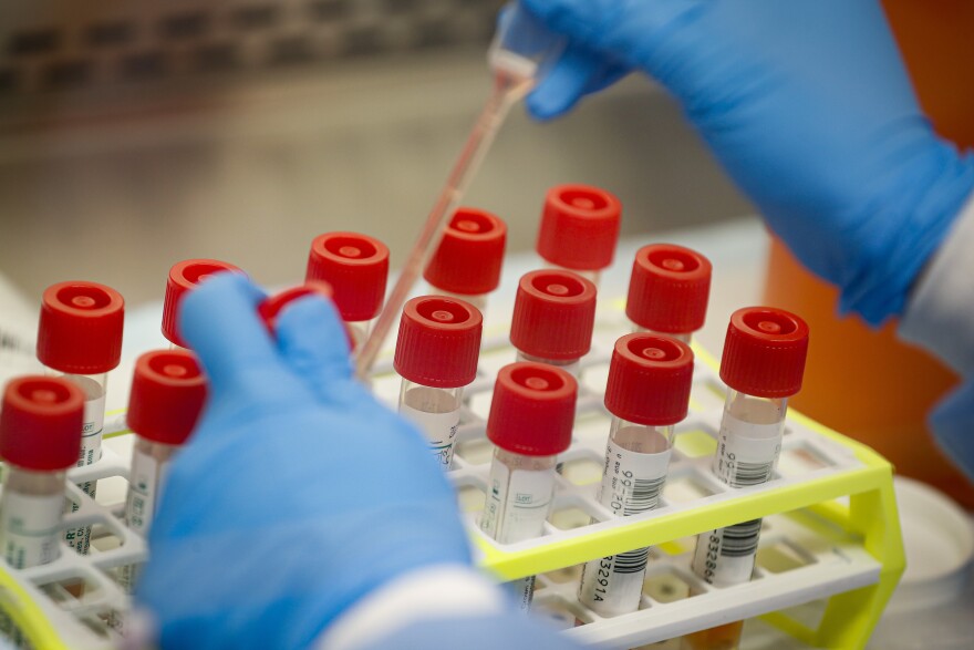 A technician prepares coronavirus test samples on New York's Long Island. The head of New York City's public labs said fighting the virus without a test was like building a house with a saw but no hammer.